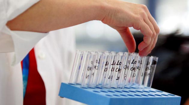 Doping, “insabbiata” la verità su Fuentes